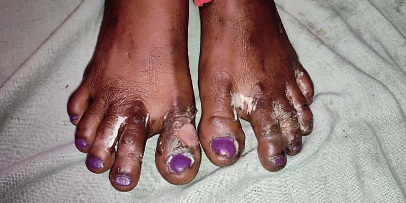 Brutally Attacked for Opposing Jat in Gram Panchayat Polls, Dalit Family Swears to Get Justice